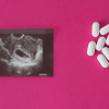 Study Finds 64 Online Abortion Pill Vendors Violate FDA Safety Regulations
